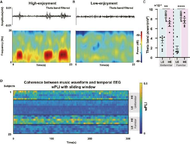 Efectos moduladores sincronizados del tratamiento musical en el EEG temporal. Crédito de la imagen: Bomin et al.