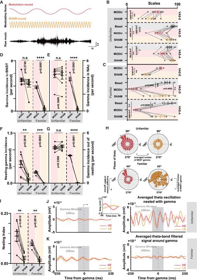 Figura 6. Respuesta activada por arrastre auditivo a la música en pacientes que no responden. Crédito de la imagen: Bomin Sun et al.