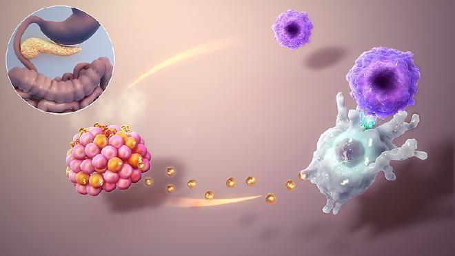 Las Células Beta (de color naranja en el haz de células inferior izquierda) son parte de las células productoras de insulina del páncreas (el órgano resaltado brillantemente en la imagen circular). En la diabetes tipo 1, un ataque autoinmune, los exosomas secretados fisiológicamente (los puntos amarillos) de las células beta son absorbidos erróneamente por las células dendríticas (células grandes y blanquecinas con brazos) y su contenido se presenta a las células T (células azules más pequeñas en la parte superior derecha). Las células T ven esos contenidos (proteínas) como enemigos y atacan a sus productores. Esto conduce a una pérdida de células beta funcionales y a una disminución de la producción de insulina. Crédito de la imagen: <a href="http://www.scientificanimations.com/wiki-images/"   target="_blank">
    Scientific Animations</a>