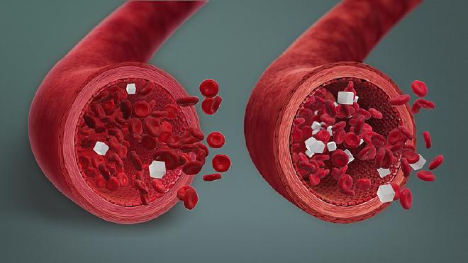 La captura de una animación médica en 3D muestra, a la izquierda, un nivel bajo de azúcar en sangre, y, a la derecha, un nivel normal de azúcar en sangre. Crédito de la imagen: Crédito de la imagen: <a href="http://www.scientificanimations.com/"   target="_blank">
    Scientific Animations</a>