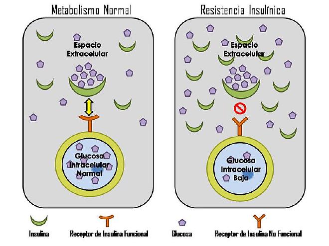 Comparación entre un metabolismo normal de la insulina y la resistencia a la insulina. Crédito de la imagen: Fj.toloza992