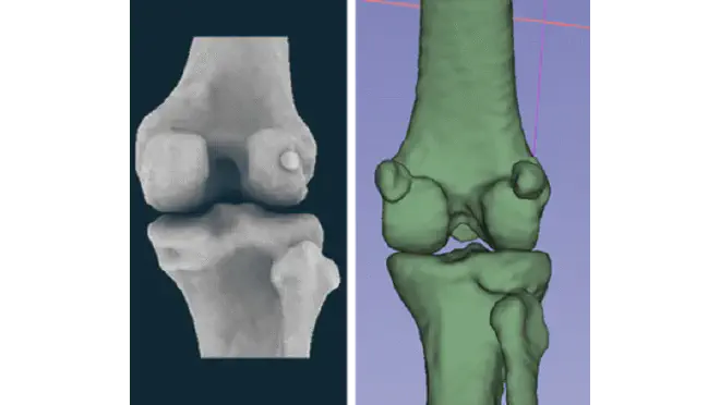 Comparación de la parte posterior de la rodilla de un humano (izq.) y un macaco (der.), que muestra la fabela medial y lateral del macaco y la fabela lateral de un humano. Crédito: Dr. Michael Berthaume e Imperial College London