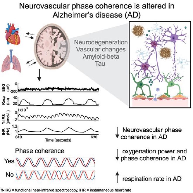 Paper&rsquo;s graphical abstract. Credit: Aneta Stefanovska et al.