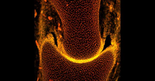 Inmunotinción que muestra la proteína del cartílago en amarillo y el núcleo en rojo en la articulación pélvica de una pequeña raya embrionaria. Crédito: Neelima Sharma