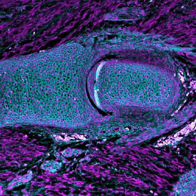 La inmunotinción muestra colágeno en cian y núcleo en magenta en la articulación pélvica de una pequeña raya embrionaria. Crédito: Neelima Sharma