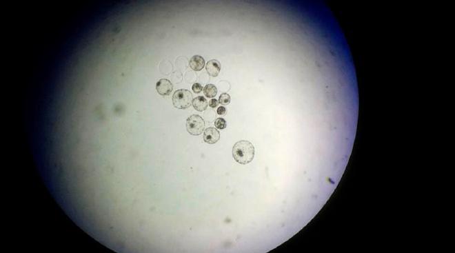 Embryo evaluation at Day 7 of development, at which time the rate of good quality and viable blastocystos can be calculated