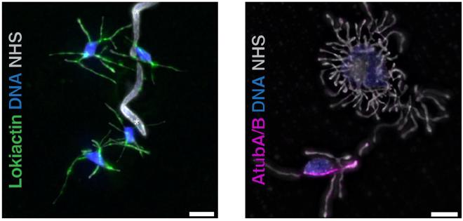 La microscopía de expansión, una novedosa técnica de microscopía óptica, muestra el citoesqueleto de las arqueas de Asgard: filamentos de actina (verde) y, en la imagen de la derecha, un microtúbulo (violeta). (Crédito de la imagen: de Wollweber F, et al. Cell, 2025)