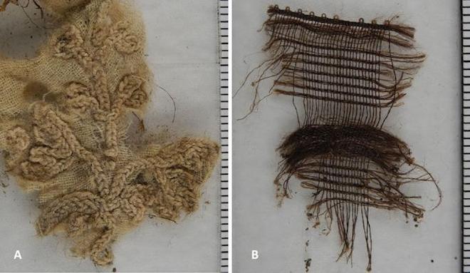 Hallazgos adicionales de tejido especial del material detectado en la cavidad abdominal de la momia: Izquierda: Un trozo de algodón con un elaborado estampado floral. Derecha: Fragmento de un tejido de seda similar al utilizado para la cruz de la momia. Crédito: Andreas Nerlich.
