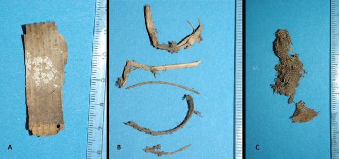 El análisis del material de empaque obtenido durante la autopsia parcial del abdomen reveló: A: Astillas de madera típicas. B: Ramitas de diversas plantas. C: Pequeño fragmento de una tela sencilla de cáñamo o lino. Imagen: Andreas Nerlich.