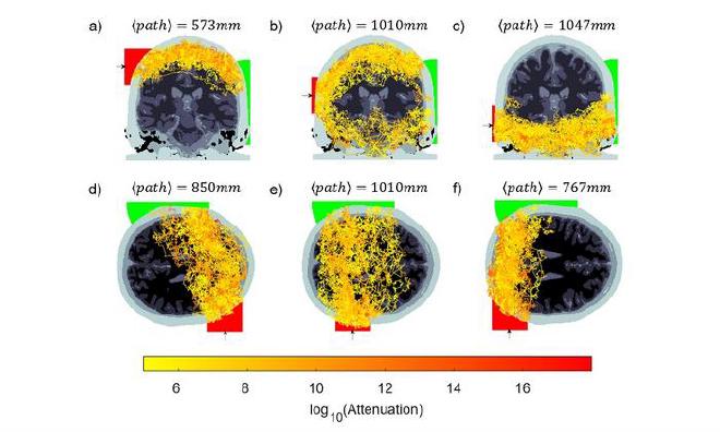 Detecting photons through an entire adult head explores the limits of photon transport in the brain, for access to regions of the brain currently inaccessible with noninvasive optical brain imaging. Credit: J. Radford et al., doi 10.1117/1.NPh.12.2.025014