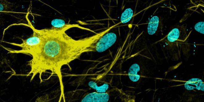 One nerve cell type (yellow) of several hundred that ETH researchers have grown from stem cells in the laboratory (microscopy image). (Image: Hsiu-Chuan Lin and Malgorzata Santel / ETH Zurich)