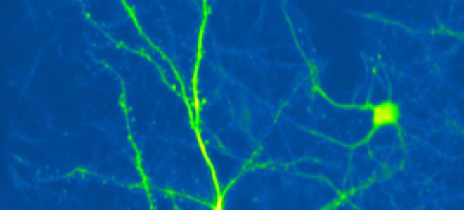Neurona cortical que expresa proteína verde fluorescente, obtenida mediante microscopía de dos fotones en el cerebro de un ratón vivo. Copyright de la imagen: Ronan Chéreau