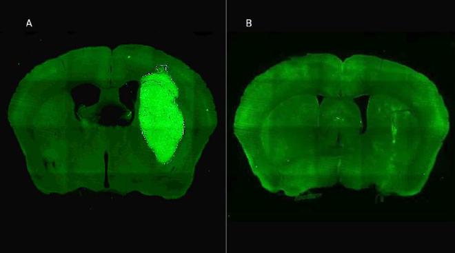 A) Se visualiza el tumor cerebral en un modelo preclínico B) El tumor desaparece gracias a la administración de la estrategia terapéutica diseñada por los especialistas del CONICET. Crédito de la imagen: Marianela Candolfi et al.