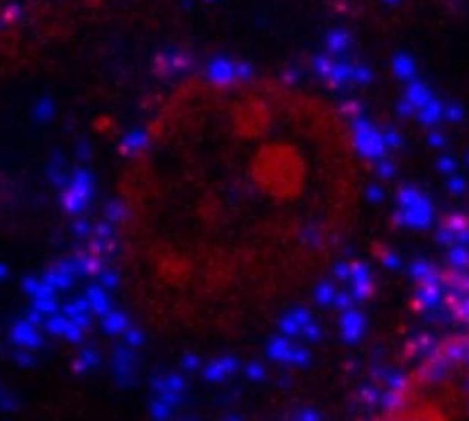 A micrograph taken at 400x magnification shows the interior of an MG-63 bone cell. Small polystyrene microplastic spheres appear inside the cytoplasm and are highlighted in blue. The cell nucleus is shown in red. Image credit: Mariana Cassani de Oliveira/LEMON/FCM-UNICAMP