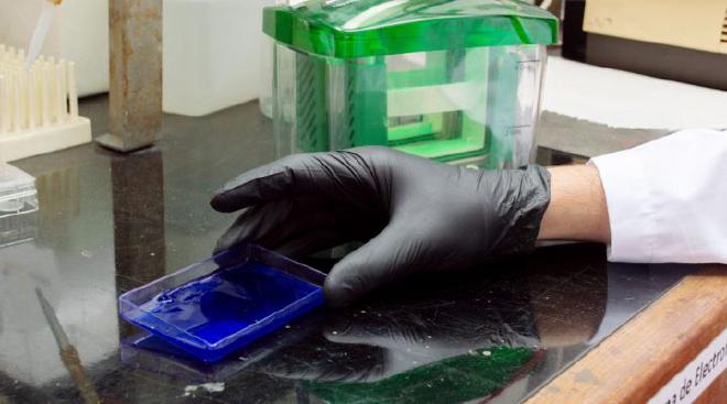 The protein mutation is linked to a greater predisposition to suffer from cardiovascular diseases at an early age. Image credit: CONICET Photography/ Rayelen Baridon