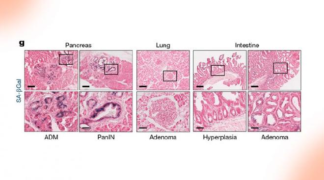 The image shows how the KRAS oncogene drives cancer progression differently in each organ. Image credit: Sebastian Mueller, Roland Rad et al.