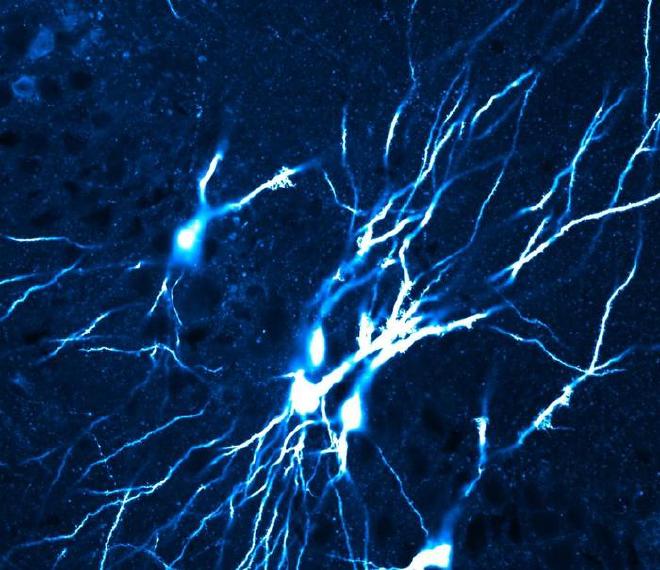 Video screenshot: Network of interconnected CA3 pyramidal neurons in the mouse hippocampus. As the animals mature, the configuration shifts—the network becomes sparser but more structured and refined (blue). Image credit: Jake Watson / ISTA