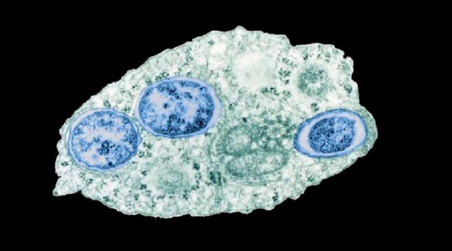Micrografía electrónica de transmisión de Wolbachia dentro de una célula de insecto. Imagen: Scott O&rsquo;Neill. https://doi.org/10.1371/journal.pbio.0020076.g001