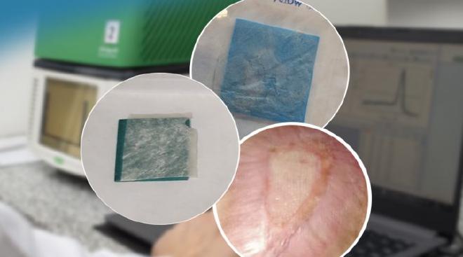The surrounding skin advanced over the ulcer much faster on the surface treated with amniotic membrane patches. Image credit: Guerbi et al..
