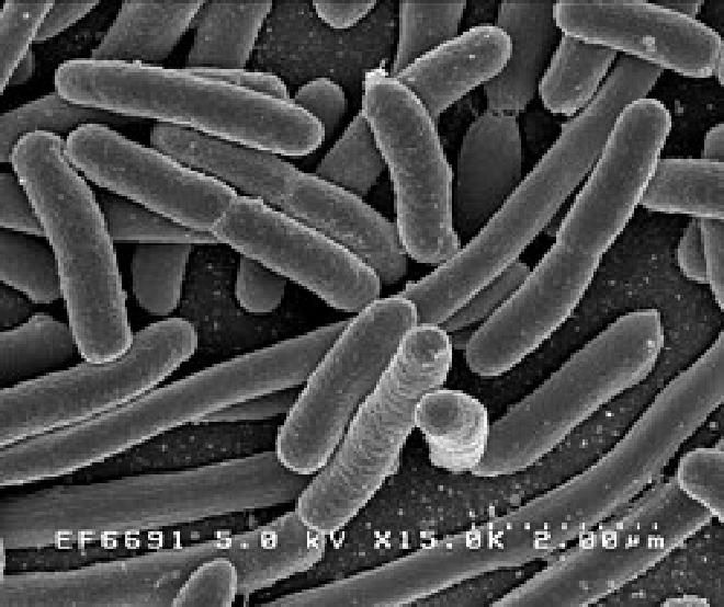 Micrografía electrónica de barrido de Escherichia coli, cultivada y adherida a un cubreobjetos. Crédito de la imagen: NIAID