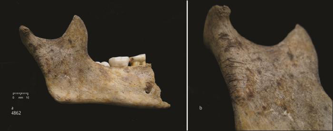 Mandíbula de niño. Hemimandíbula derecha de un niño de unos 10 años (a) con detalle de las marcas de corte en la rama ascendente (b). Crédito de la imagen: Schulting et al. Antiquity, diciembre de 2024