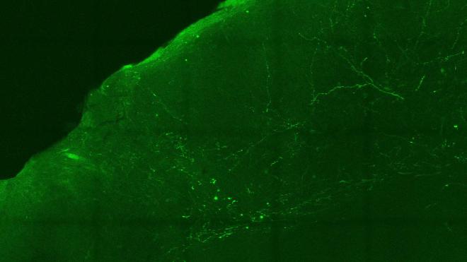 Las vías neuronales, teñidas de verde neón arriba, transportan señales olfativas a través del cerebro del ratón desde la amígdala basal hasta la corteza auditiva. Credit: Stephen Shea et al.