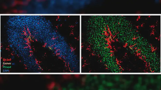 Imagen de microscopía del giro dentado del hipocampo. Los colores muestran la expresión de genes en los distintos estados celulares descriptos en el trabajo